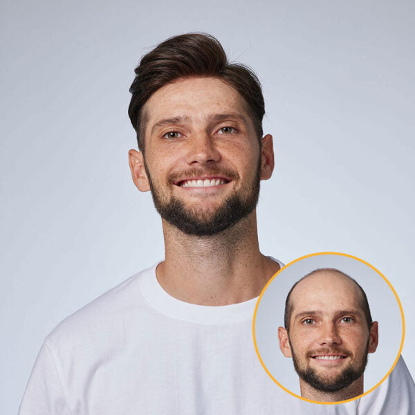 Tom -Hair System – 0.06 mm Poly Thin Skin