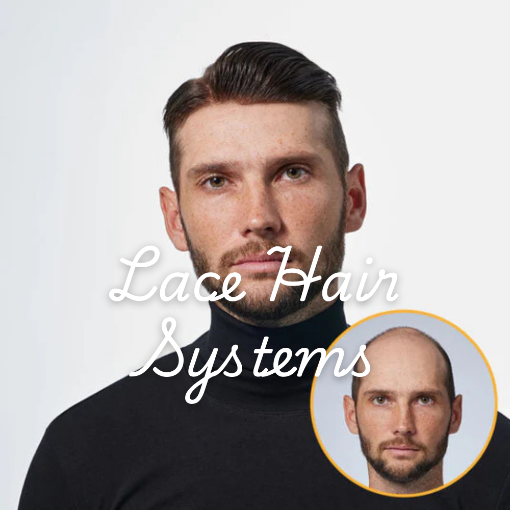 Lace Hair Systems